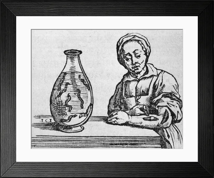 Framed Print : Woman applying a medicinal leech to her forearm, woodcut from a 1639 treatise by Belgian, Joannis Mommarti