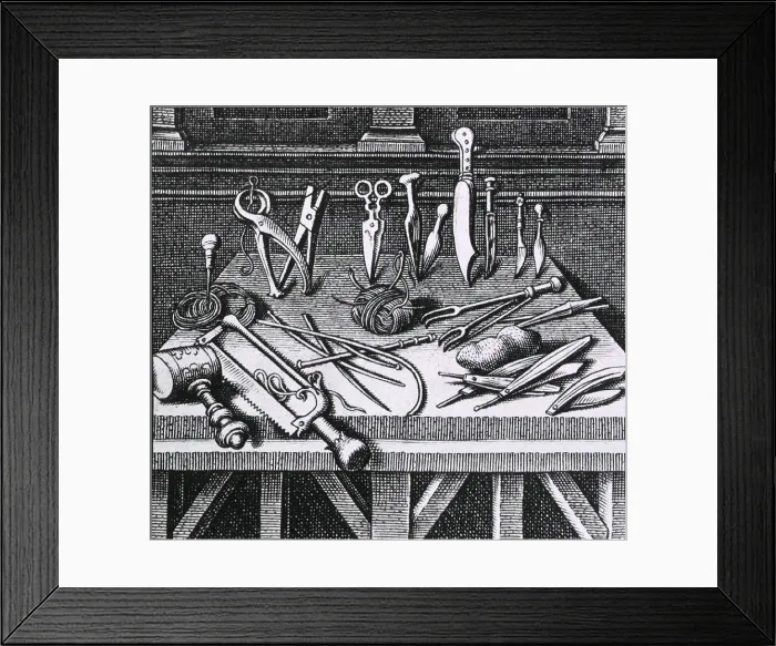 Framed Print : 16th century surgical equipment and instruments arranged on a table. From Ambroise Pare's, DIX LIVRES DE LA CHIRURGIE (TEN BOOKS ON SURGERY), 1564 Framed Print : 16th century surgical equipment and instruments arranged on a table. From Ambroise Pare's, DIX LIVRES DE LA CHIRURGIE (TEN BOOKS ON SURGERY), 1564