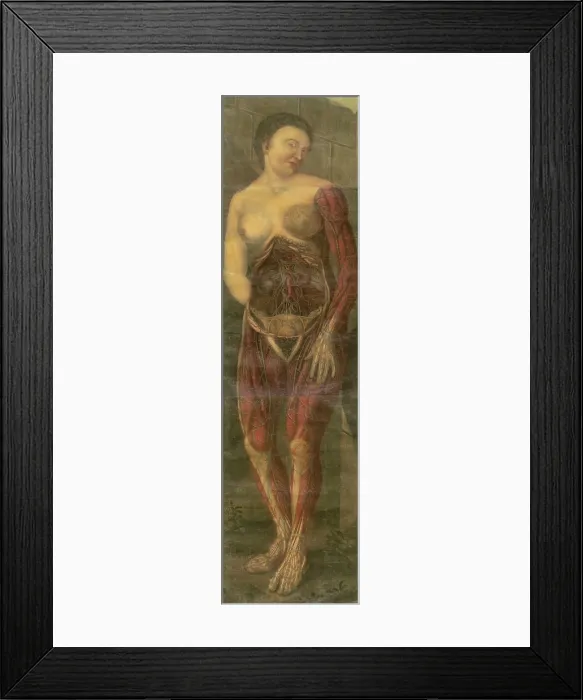 Framed Print : Visually sensational anatomical illustration of a woman from ANATOMIE GENERALE DES VISCERES, by Gautier d'Agoty, 1722
