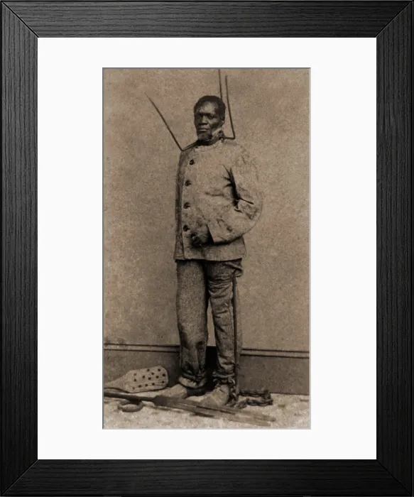 Framed Print : Wilson Chinn, a sixty year old former slave was branded on the forehead with his owner's initials, V. B