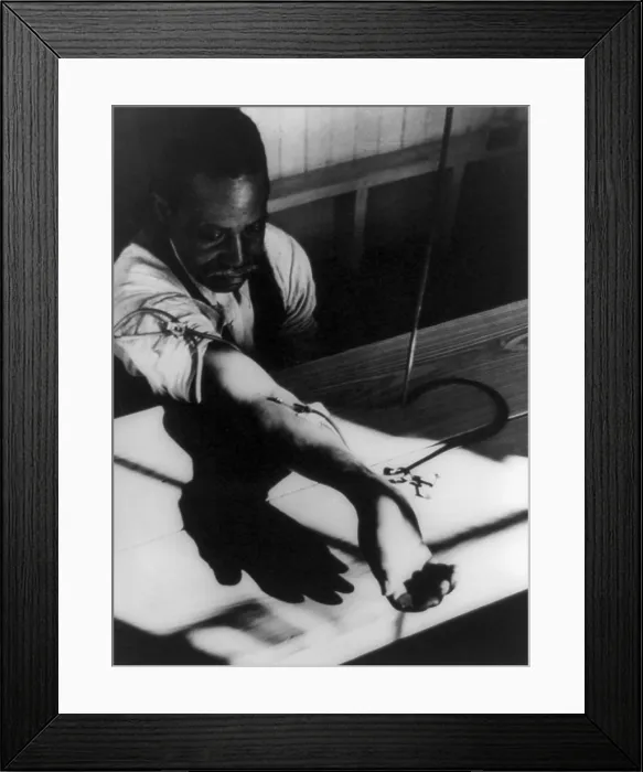 Framed Print : African American man receiving intravenous treatment for venereal disease, Georgia, ca. 1940. Treatment for syphilis was the potentially toxic arsenic-containing drug Salvarsan Framed Print : African American man receiving intravenous treatment for venereal disease, Georgia, ca. 1940. Treatment for syphilis was the potentially toxic arsenic-containing drug Salvarsan