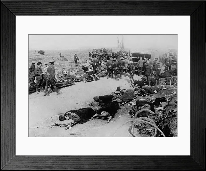 Framed Print : Wounded British soldiers on the battlefield near Ginchy, France, during World War 1 Somme Offensive, Sept. 1916