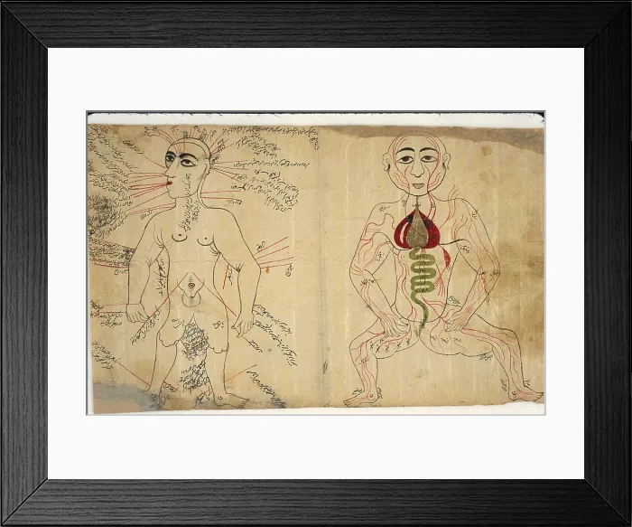 Framed Print : Two anatomical drawings from a Persian-language medical encyclopedia. Left figure shows a bloodletting points labeled on a body