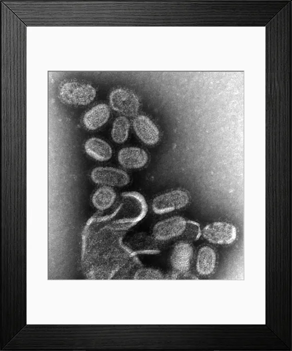 Framed Print : 1918 influenza virions (virus particles)