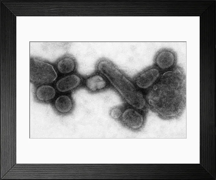 Framed Print : 1918 influenza virions (virus particles)