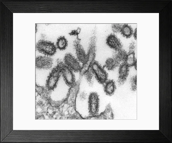 Framed Print : 1918 influenza virions (virus particles)
