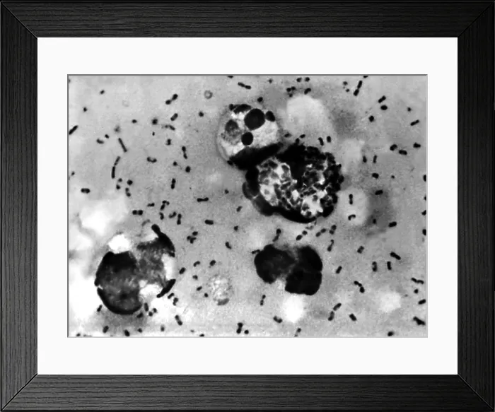 Framed Print : Yersinia pestis bacteria which caused Bubonic Plague. 1965 Framed Print : Yersinia pestis bacteria which caused Bubonic Plague. 1965