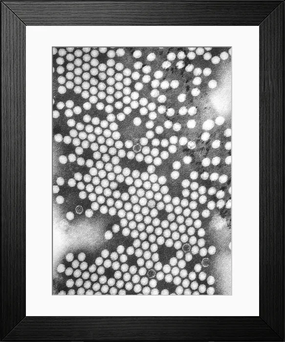 Framed Print : Electron micrograph of the poliovirus. 1975 Framed Print : Electron micrograph of the poliovirus. 1975