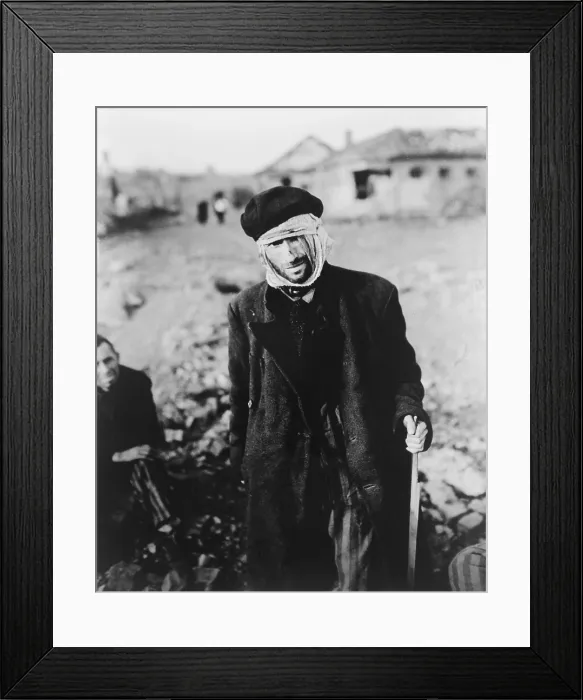 Framed Print : Starved, almost blind Russian slave laborer at Nordhausen concentration camp. Photo was taken shortly after the German camp's liberation by U.S. Army
