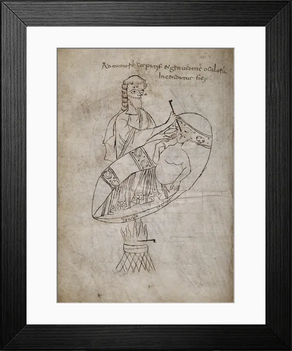 Framed Print : Demonstration of the Application of Thermocautery, Scriptorium Cassinese, 9th Century, drawing - Italy, Tuscany, Florence, Medicea Laurenziana Library. Whole artwork view Framed Print : Demonstration of the Application of Thermocautery, Scriptorium Cassinese, 9th Century, drawing - Italy, Tuscany, Florence, Medicea Laurenziana Library. Whole artwork view