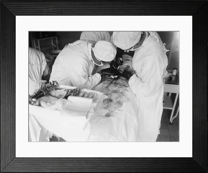 Framed Print : Attending surgeon leans over to work closely over a patient's abdomen. The surgical field is stained with blood. 1922 in a hospital in Washington, D.C. (BSLOC_2016_10_36) Framed Print : Attending surgeon leans over to work closely over a patient's abdomen. The surgical field is stained with blood. 1922 in a hospital in Washington, D.C. (BSLOC_2016_10_36)