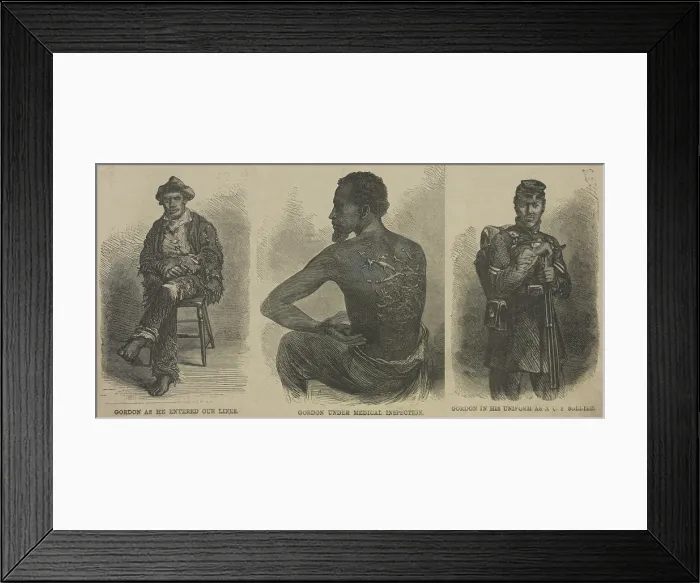 Framed Print : Escaped slave Gordon, whose scarred back from whipping is evidence of the brutality of American slavery Framed Print : Escaped slave Gordon, whose scarred back from whipping is evidence of the brutality of American slavery