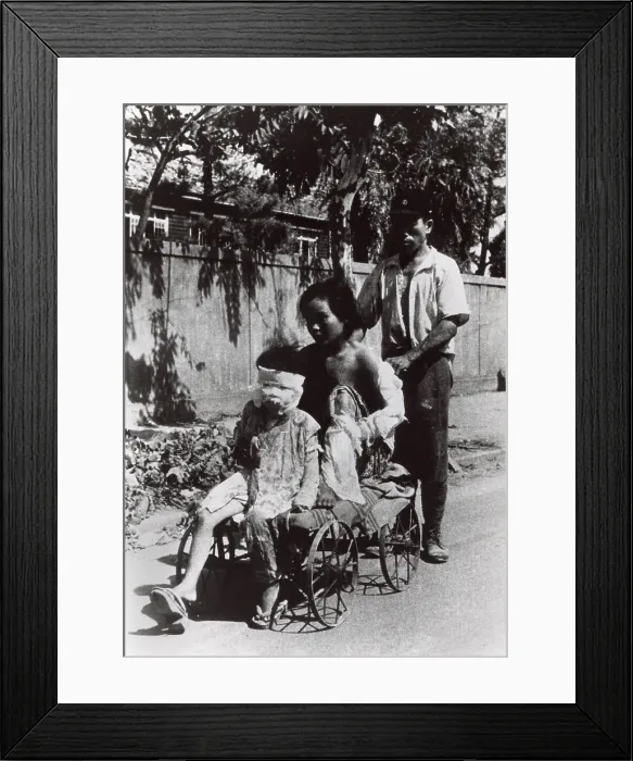 Framed Print : Nagasaki atomic bomb survivors who have received some medical care. Japan, August 12, 1945. World War 2. (BSLOC_2014_6_93)