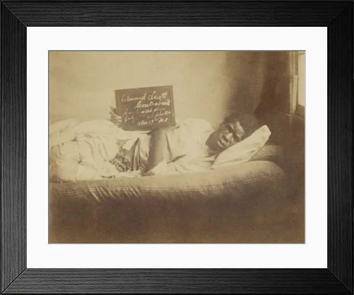 Framed Print : African American, Edward Scott, is photographed in a Union Civil War hospital with an open abdominal wound. The slate describes him as a contraband, on Nov. 15th, 1865 Framed Print : African American, Edward Scott, is photographed in a Union Civil War hospital with an open abdominal wound. The slate describes him as a contraband, on Nov. 15th, 1865