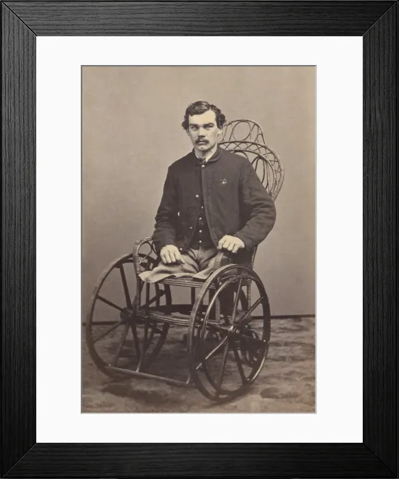 Framed Print : Corporal Michael Dunn of Co. H, 46th Pennsylvania Infantry Regiment, lost both of his legs in battle near Dallas, Georgia, on May 25, 1864 Framed Print : Corporal Michael Dunn of Co. H, 46th Pennsylvania Infantry Regiment, lost both of his legs in battle near Dallas, Georgia, on May 25, 1864
