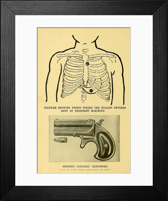 Framed Print : Assassination of President William McKinley at Pan-American Exposition, Buffalo, Sept. 5, 1901. McKinleys upper wound was minor, as the bullet was stopped by the breast bone
