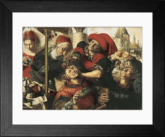 Framed Print : HEMESSEN, Jan Sanders van (1500-1564). The Surgeon. 1555. The surgeon removes the stone of the madness. Flemish art. Oil on wood. SPAIN. Madrid. Prado Museum