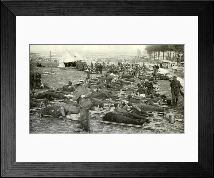 Framed Print : World War 1. Somme Offensive. Rows of wounded men on stretchers, behind the Allies front in France, waiting to be taken from the battlefield