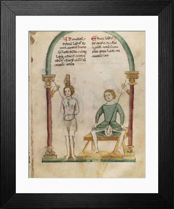 Framed Print : Cauterization and preparation. Miniature. Ms.Rawlinson C 328 fol. 9r. Miniature Painting. UNITED KINGDOM. Oxford. Bodleian Library. AISA / Everett Collection**US SALES ONLY** Framed Print : Cauterization and preparation. Miniature. Ms.Rawlinson C 328 fol. 9r. Miniature Painting. UNITED KINGDOM. Oxford. Bodleian Library. AISA / Everett Collection**US SALES ONLY**