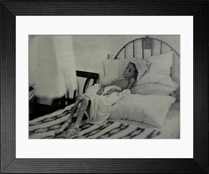 Framed Print : Child victim of starvation in Cuba during the Cuban War of Independence, 1895-1898