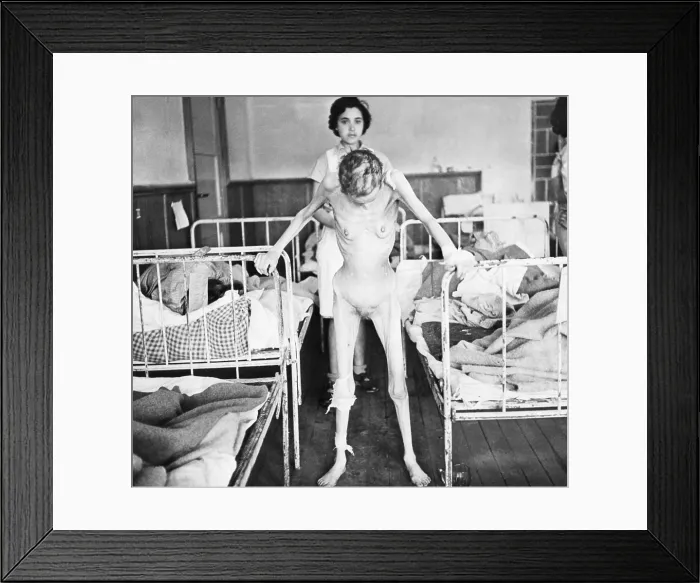 Framed Print : Margit Schwartz, 31 years old Hungarian Jew in the hospital at Belsen Concentration Camp, May 1945 Framed Print : Margit Schwartz, 31 years old Hungarian Jew in the hospital at Belsen Concentration Camp, May 1945