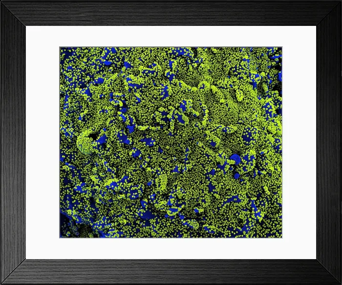 Framed Print : Novel Coronavirus SARS-CoV-2 Framed Print : Novel Coronavirus SARS-CoV-2