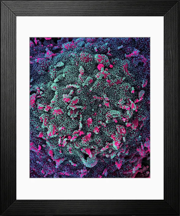 Framed Print : Novel Coronavirus SARS-CoV-2