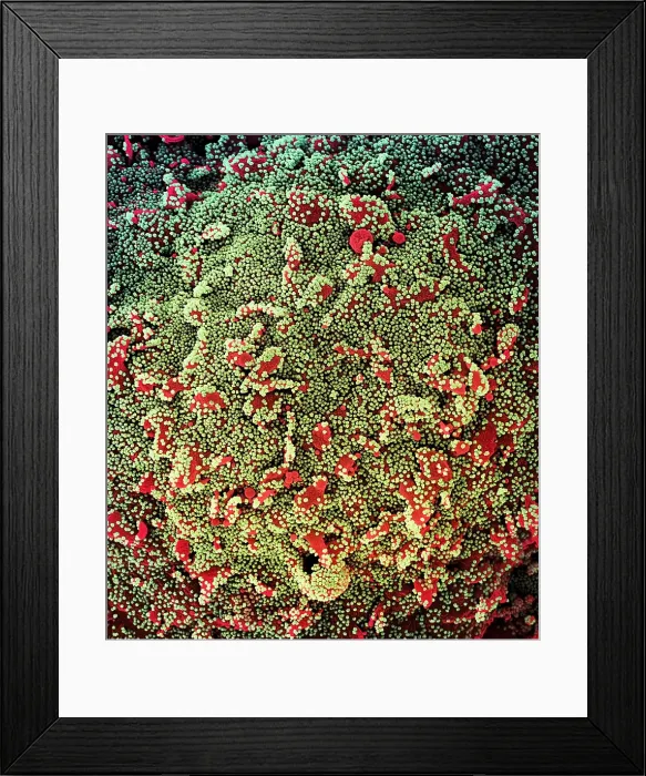 Framed Print : Novel Coronavirus SARS-CoV-2