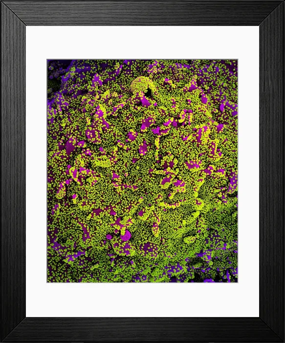 Framed Print : Novel Coronavirus SARS-CoV-2 Framed Print : Novel Coronavirus SARS-CoV-2