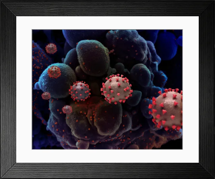 Framed Print : Creative NIAID illustration of SARS-CoV-2 virus particles, with an infected cell in the background (BSLOC_2021_1_28) Framed Print : Creative NIAID illustration of SARS-CoV-2 virus particles, with an infected cell in the background (BSLOC_2021_1_28)