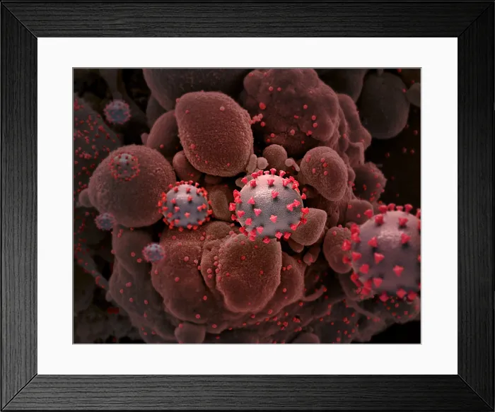 Framed Print : Creative NIAID illustration of SARS-CoV-2 virus particles, with an infected cell in the background (BSLOC_2021_1_29) Framed Print : Creative NIAID illustration of SARS-CoV-2 virus particles, with an infected cell in the background (BSLOC_2021_1_29)