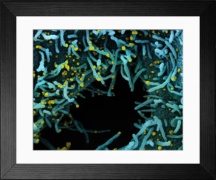 Framed Print : Novel Coronavirus SARS-CoV-2 Framed Print : Novel Coronavirus SARS-CoV-2