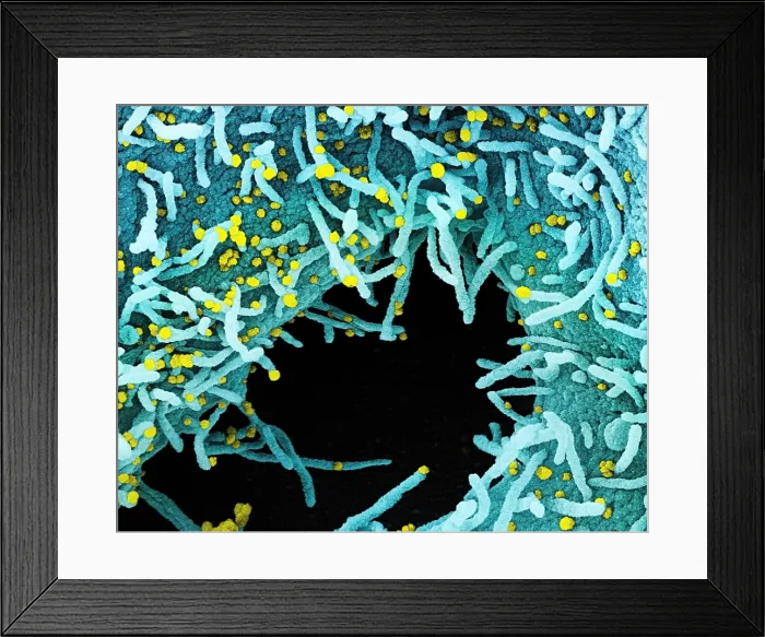 Framed Print : Novel Coronavirus SARS-CoV-2