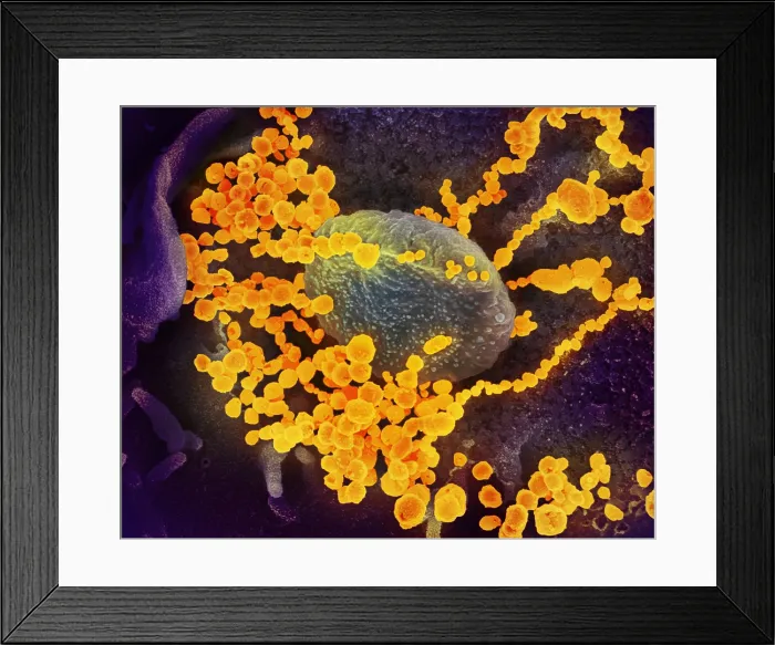 Framed Print : SARS-CoV-2 (round gold objects) emerging from the surface of patient cells cultured in the lab. SARS-CoV-2 is the virus that causes COVID-19, coronavirus disease Framed Print : SARS-CoV-2 (round gold objects) emerging from the surface of patient cells cultured in the lab. SARS-CoV-2 is the virus that causes COVID-19, coronavirus disease