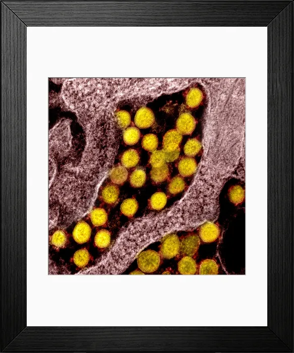 Framed Print : Novel Coronavirus SARS-CoV-2, the virus that causes COVID19 Framed Print : Novel Coronavirus SARS-CoV-2, the virus that causes COVID19