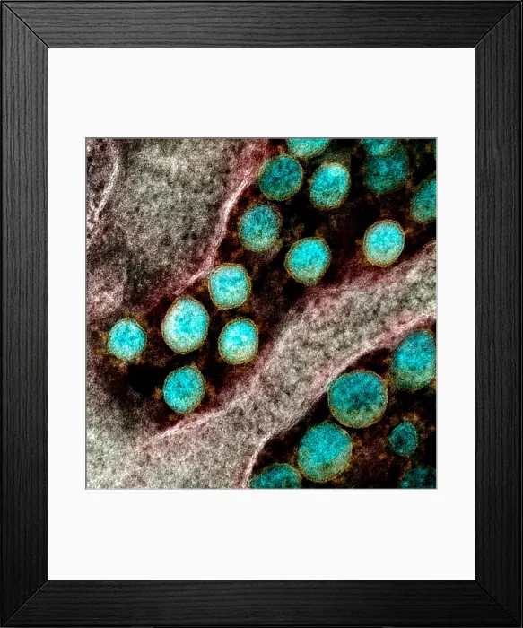 Framed Print : Novel Coronavirus SARS-CoV-2, the virus that causes COVID19 Framed Print : Novel Coronavirus SARS-CoV-2, the virus that causes COVID19