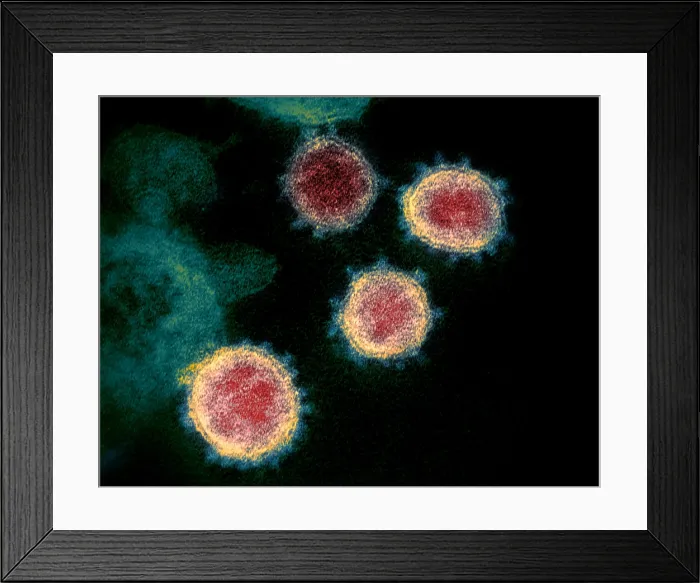 Framed Print : Novel Coronavirus SARS-CoV-2, causes coronavirus disease-2019, abbreviated as COVID-19