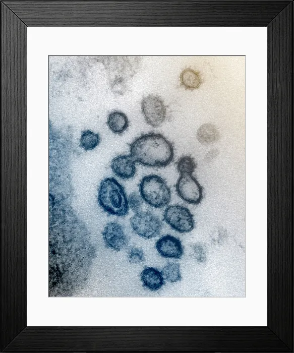 Framed Print : Novel Coronavirus SARS-CoV-2, causes coronavirus disease-2019, abbreviated as COVID-19 Framed Print : Novel Coronavirus SARS-CoV-2, causes coronavirus disease-2019, abbreviated as COVID-19