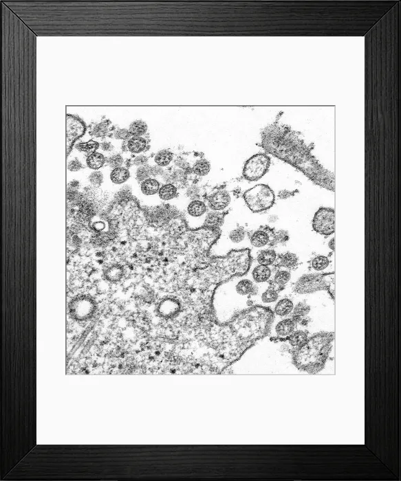 Framed Print : Novel Coronavirus SARS-CoV-2, causes coronavirus disease-2019, abbreviated as COVID-19