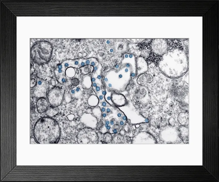 Framed Print : Novel Coronavirus SARS-CoV-2, also called, severe acute respiratory syndrome coronavirus 2, causes coronavirus disease-2019, abbreviated as COVID-19