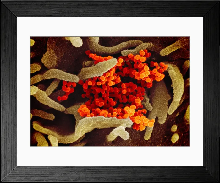 Framed Print : Novel Coronavirus SARS-CoV-2, causes coronavirus disease-2019, abbreviated as COVID-19