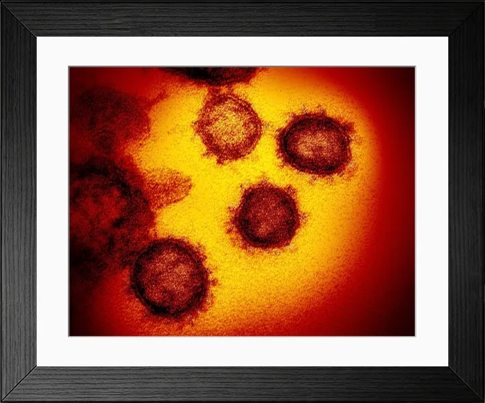 Framed Print : Novel Coronavirus SARS-CoV-2, causes coronavirus disease-2019, abbreviated as COVID-19