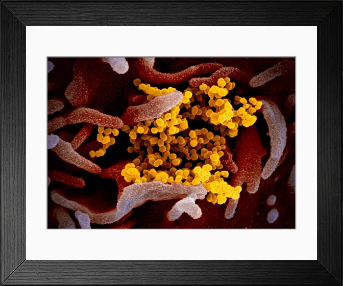 Framed Print : Novel Coronavirus SARS-CoV-2, causes coronavirus disease-2019, abbreviated as COVID-19 Framed Print : Novel Coronavirus SARS-CoV-2, causes coronavirus disease-2019, abbreviated as COVID-19