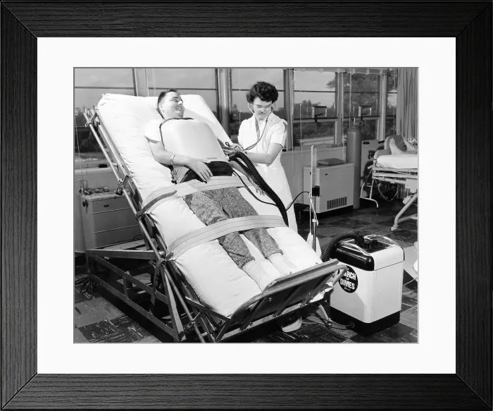 Framed Print : A 30 year old polio patient wearing a chest respirator on a standing bed. This relieves pressure on the back from the horizontal bed of iron lungs