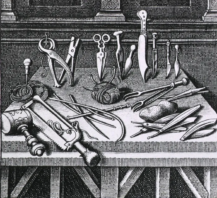 Framed Print : 16th century surgical equipment and instruments arranged on a table. From Ambroise Pare's, DIX LIVRES DE LA CHIRURGIE (TEN BOOKS ON SURGERY), 1564 Framed Print : 16th century surgical equipment and instruments arranged on a table. From Ambroise Pare's, DIX LIVRES DE LA CHIRURGIE (TEN BOOKS ON SURGERY), 1564