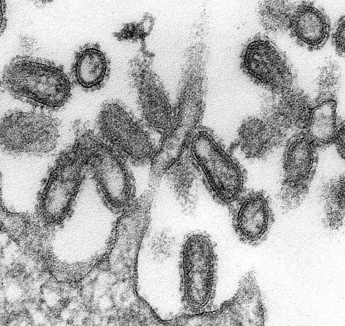 Framed Print : 1918 influenza virions (virus particles)