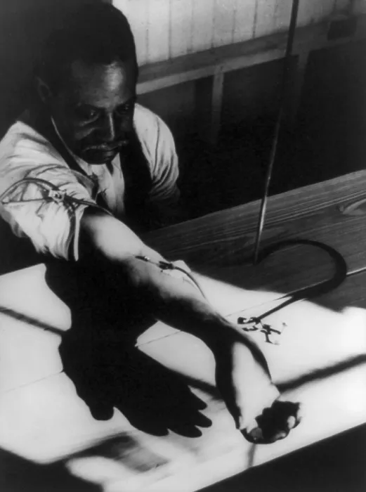 Framed Print : African American man receiving intravenous treatment for venereal disease, Georgia, ca. 1940. Treatment for syphilis was the potentially toxic arsenic-containing drug Salvarsan Framed Print : African American man receiving intravenous treatment for venereal disease, Georgia, ca. 1940. Treatment for syphilis was the potentially toxic arsenic-containing drug Salvarsan