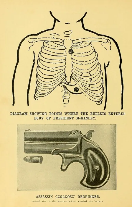 Framed Print : Assassination of President William McKinley at Pan-American Exposition, Buffalo, Sept. 5, 1901. McKinleys upper wound was minor, as the bullet was stopped by the breast bone