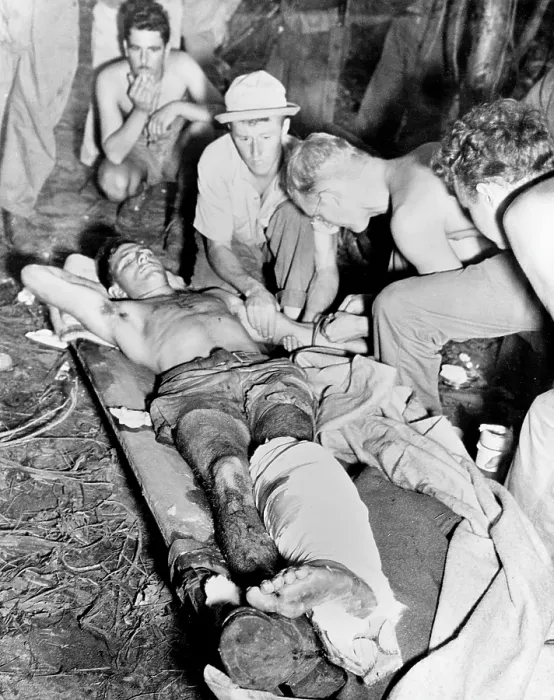 Framed Print : Blood Transfusion. A wounded American soldier gets a blood transfusion while assistants hover about the improvised cot. The scene is 'somewhere in New Guinea', 1943-1945
