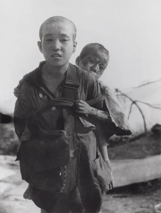 Framed Print : Two brothers who survived the blast of the Nagasaki atomic bomb of Aug. 9, 1945. Japan. Photo taken by Yosuke Yamahata the following day. World War 2. (BSLOC_2014_6_91)